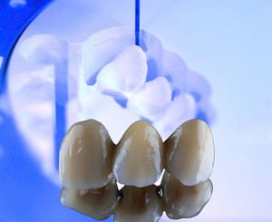 Full Zirconia