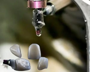 customabutment