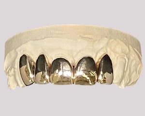 fmc1