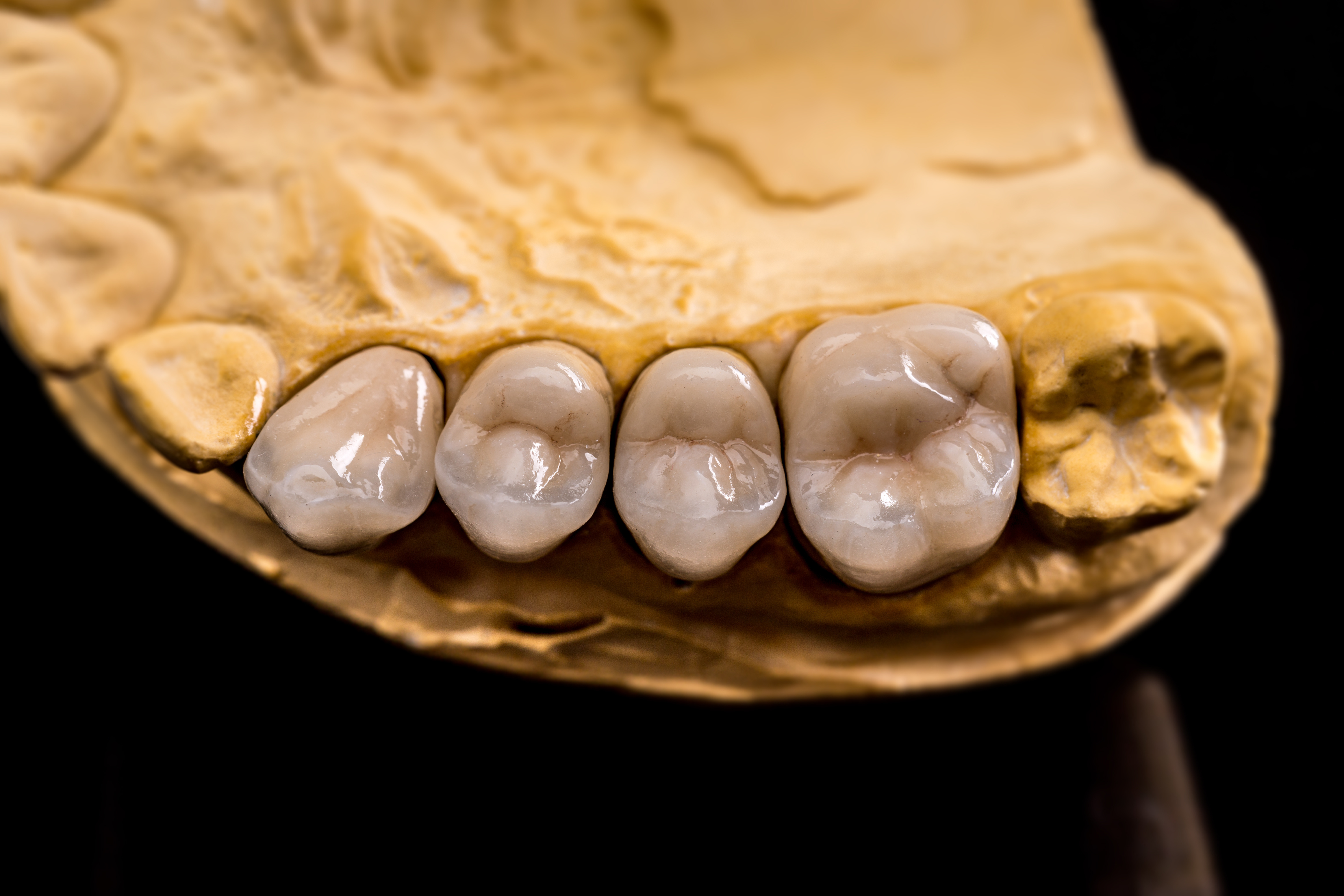 Dental lab workflow