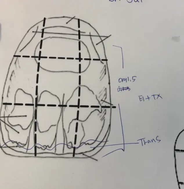 Britt S. custom shade case