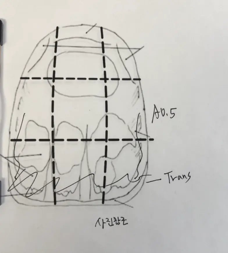 C. Kura custom shade case