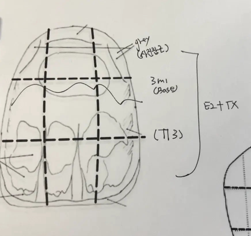 Lisa A. custom shade case