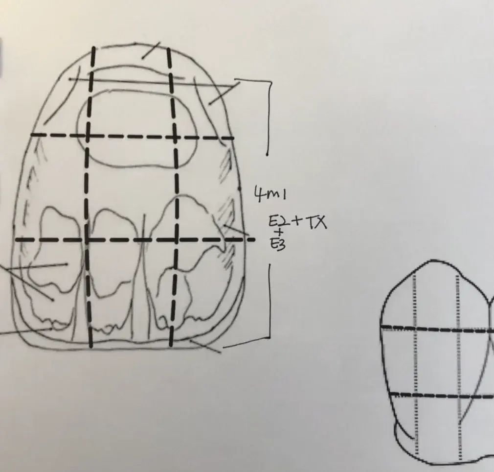 Donald Ga. custom shade case