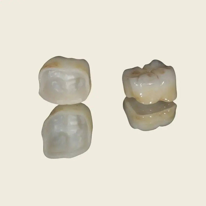 Lithium Disilicate Crowns