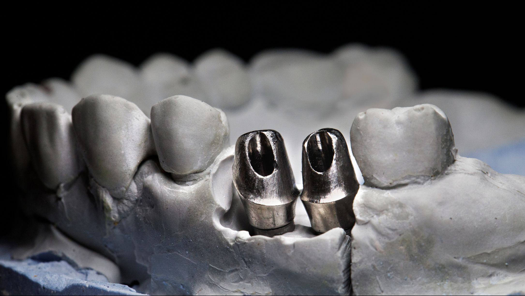 Titanium Abutment