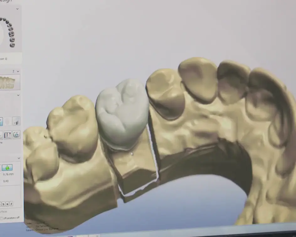 Dental products